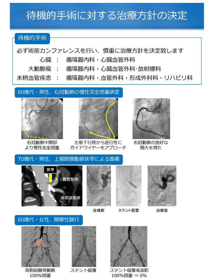 待機的手術に対する治療方針の決定