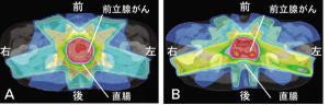 ＩＭＲＴ①