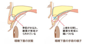 さぷりめんと図6