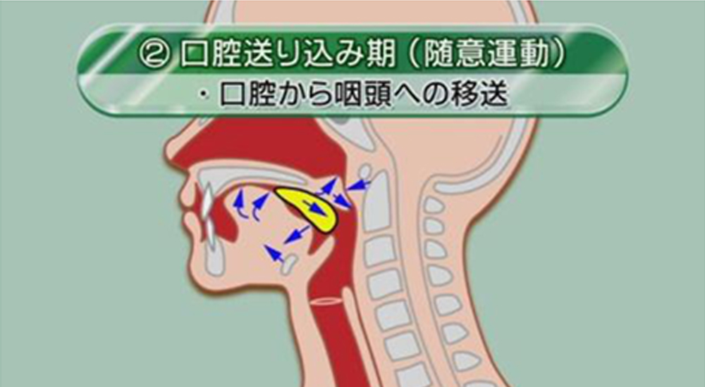 痰 が 絡む 病気