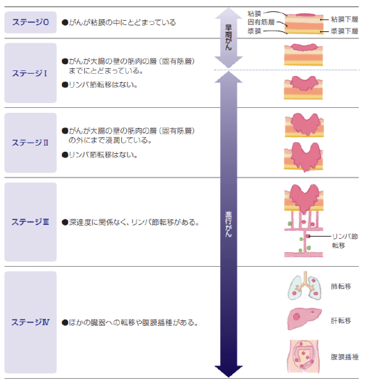 下部消化器外科 小腸 大腸 関西ろうさい病院 兵庫県尼崎市 地域医療支援病院 がん診療連携拠点病院