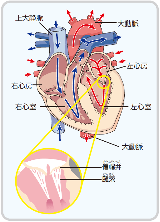 僧 帽 弁 閉鎖 不全 症