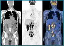 高度医療機器「PET-CT」によるがん診断を行っています！ | 関西ろう