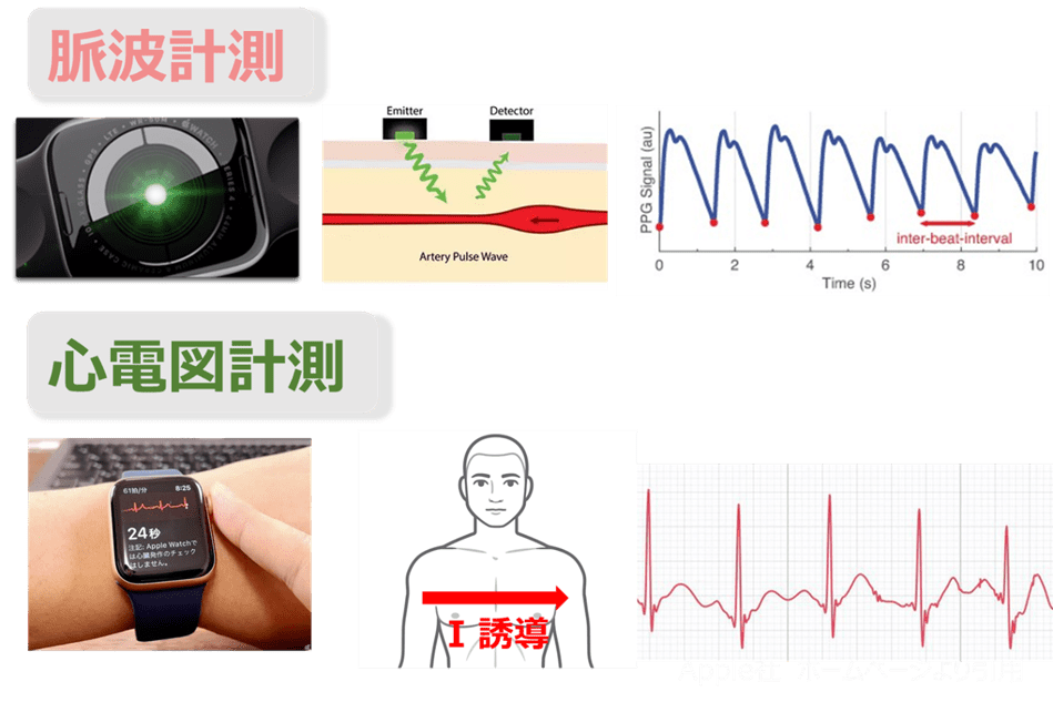 図１　アップルウォッチが心房細動を検出するために用いる二つの計測機能