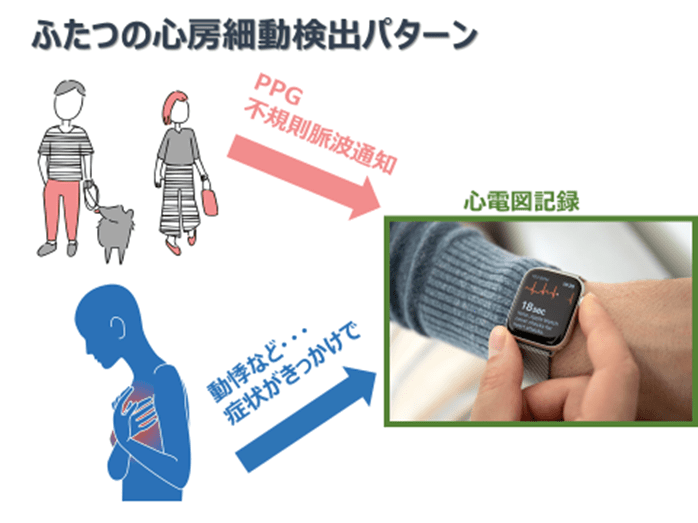 （図４）心房細動の検出パターン