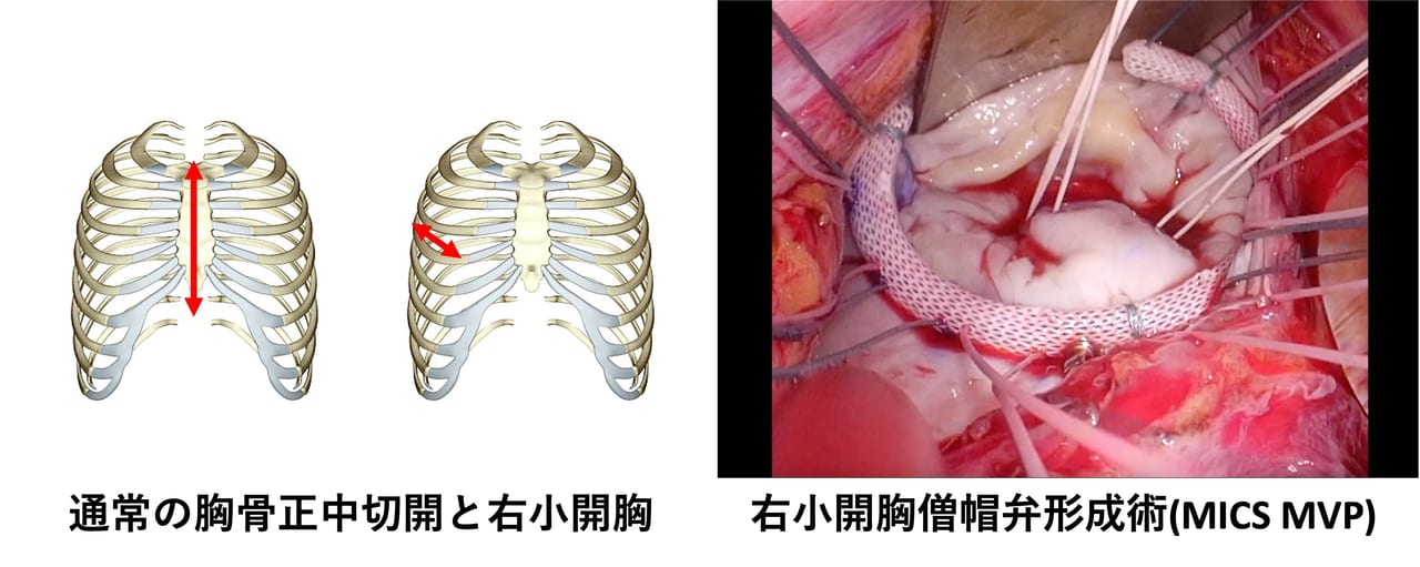 図１